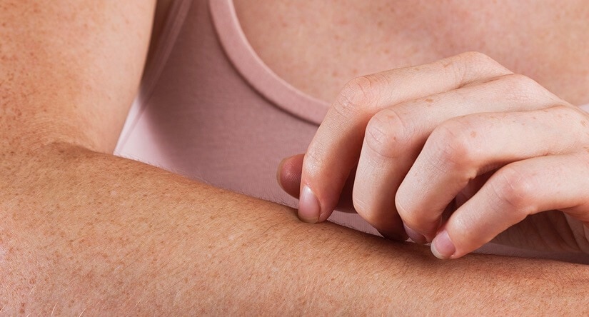 Cómo cuidar de la piel con picores: causas, tratamiento y prevención