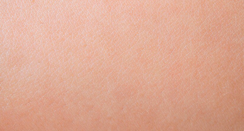 Cómo cuidar de la piel sensible: causas, tratamiento y prevención Cómo cuidar de la piel sensible: causas, tratamiento y prevención